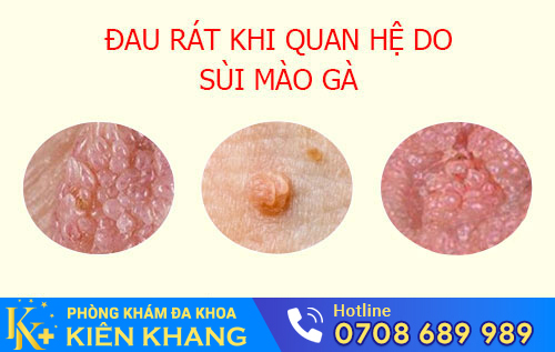 nguyên nhân đau rát khi quan hệ