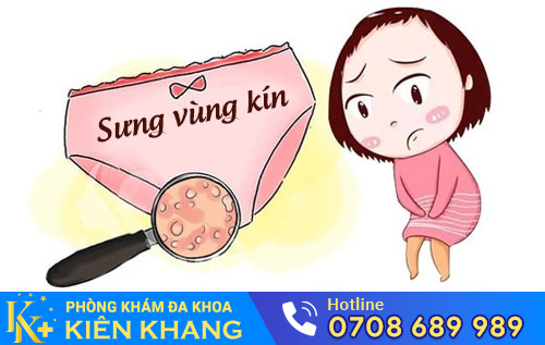 sưng vùng kín