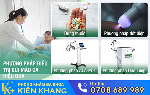 Gặp bác sĩ để được hỗ trợ điều trị bệnh sùi màu gà hiệu quả
