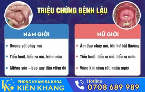 trieu chung benh lau